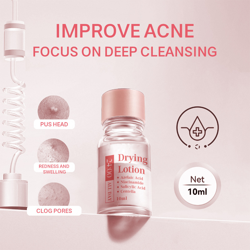 β¨ 50% KORTING β Salicylzuur Spot Drying Lotion! π Werking 's nachts, snelle vermindering van puistjes en huidherstel πββοΈπ§Huidherstel πββοΈπ§