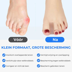 Ergonomische Teenspreider - 2 Stuks