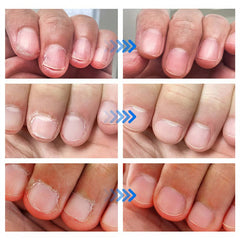 Helende en Reinigende Nagelreparatie Gel
