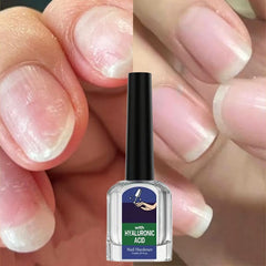 Helende en Reinigende Nagelreparatie Gel